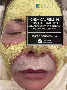 Chemical Peels in Clinical Practices