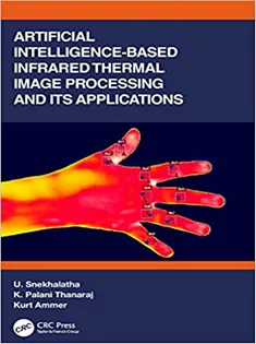 Artificial Intelligence-based Infrared Thermal Image Processing and Its Applications
