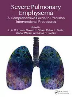 Severe Pulmonary Emphysema: A Comprehensive Guide to Precision Interventional Procedures
