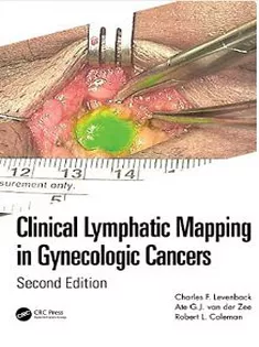 Clinical Lymphatic Mapping in Gynecologic Cancers