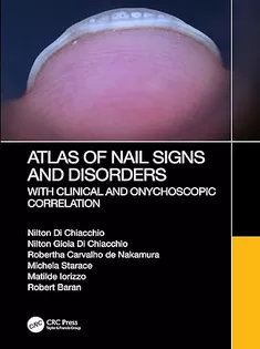 Atlas of Nail Signs and Disorders with Clinical and Onychoscopic Correlation
