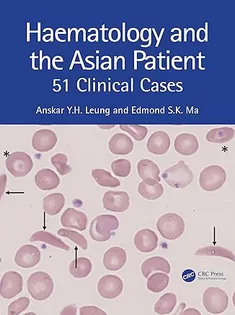 Haematology and the Asian Patient: 51 Clinical Cases