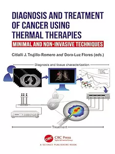 Diagnosis and Treatment of Cancer Using Thermal Therapies