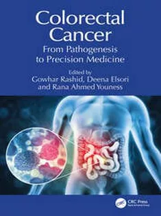 Colorectal Cancer From Pathogenesis to Precision Medicine