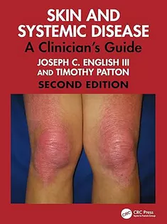 Skin and Systemic Disease: A Clinician's Guide
