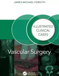 Vascular Surgery:: Illustrated Clinical Cases (ISSN)