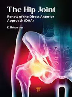 The Hip Joint Modified Posterior Approach