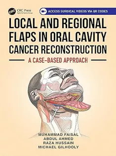 Local and Regional Flaps in Oral Cavity Cancer Reconstruction