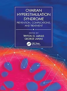 Ovarian Hyperstimulation Syndrome: Prevention, Complications, and Treatment