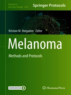 Melanoma