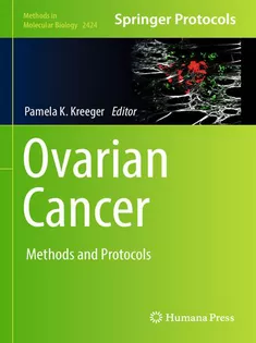 Ovarian Cancer
