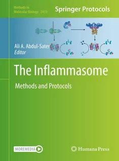 The Inflammasome