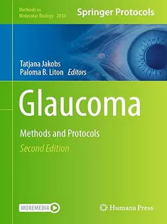 Glaucoma: Methods and Protocols