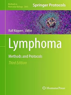 Lymphoma: Methods and Protocols