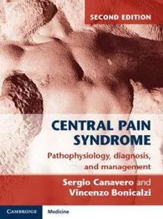 Central Pain Syndrome