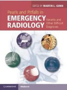 Pearls and Pitfalls in Emergency Radiology