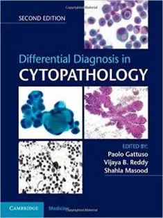 Differential Diagnosis in Cytopathology