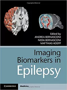 Imaging Biomarkers in Epilepsy