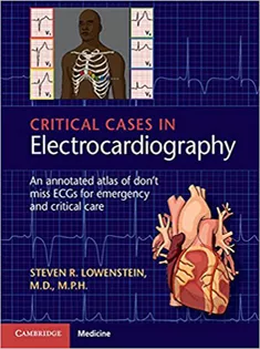 Critical Cases in Electrocardiography