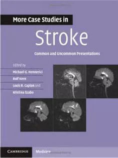 More Case Studies in Stroke: Common and Uncommon Presentations