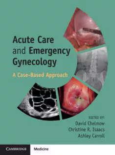 Acute Care and Emergency Gynecology: A Case-Based Approach