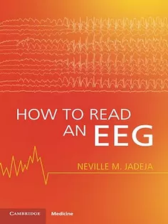 How to Read An EEG