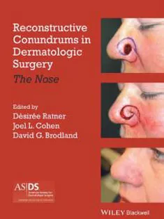 Reconstructive Conundrums in Dermatologic Surgery: The Nose