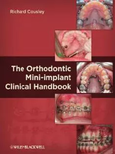 The Orthodontic Mini-implant Clinical Handbook1
