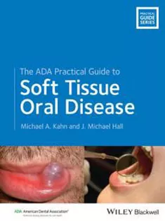 The ADA Practical Guide to Soft Tissue Oral Disease