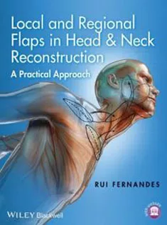 9781118340332 Local and Regional Flaps in Head & Neck Reconstruction