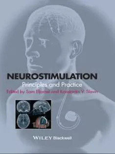 Neurostimulation: Principles and Practice