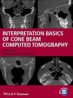 Interpretation Basics of Cone Beam Computed Tomography 1