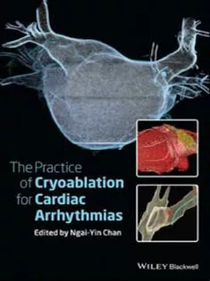 The Practice of Catheter Cryoablation for Cardiac Arrhythmias
