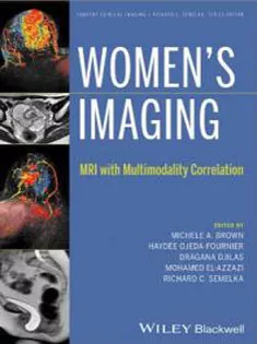 Women's Imaging: MRI with Multimodality Correlation