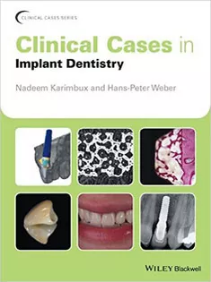 Clinical Cases in Implant Dentistry