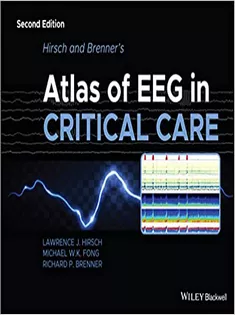 Hirsch and Brenner’s Atlas of EEG in Critical Care