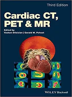 Cardiac CT, PET and MR