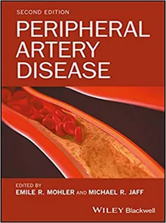 Peripheral Artery Disease