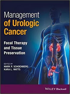 9781118864623 Management of Urologic Cancer: Focal Therapy and Tissue Preservation