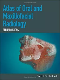 9781118939642 Atlas of Oral and Maxillofacial Radiology