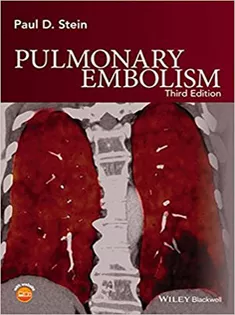 9781119039082 Pulmonary Embolism