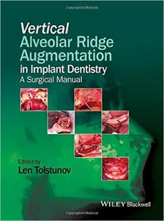 Vertical Alveolar Ridge Augmentation in Implant Dentistry: A Surgical Manual