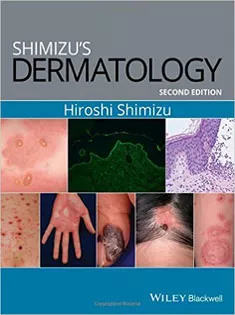 9781119099055 Shimizu's Dermatology