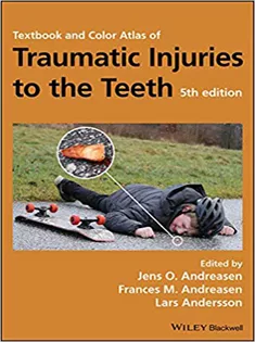 9781119167051 Textbook and Color Atlas of Traumatic Injuries to the Teeth
