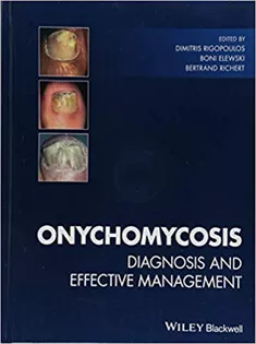 9781119226536 Onychomycosis Diagnosis and Effective Management