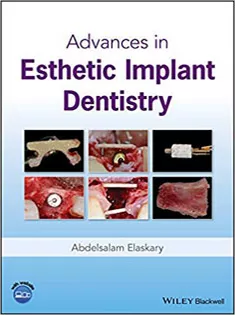 Advances in Esthetic Implant Dentistry