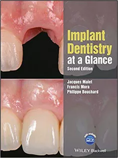 Implant Dentistry at A Glance