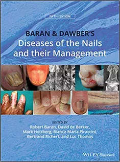 9781119323358 Baran and Dawber's Diseases of the Nails and Their Management