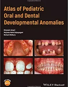 Atlas of Pediatric Oral and Dental Developmental Anomalies
