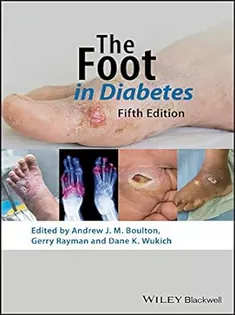 9781119445814 The Foot in Diabetes (Practical Diabetes)